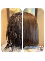 ヴィサージュロカ(VISAGE Loca) 抗がん剤治療後の「メタバーサル矯正」