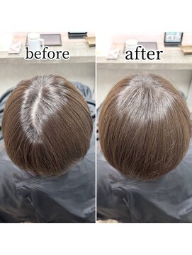 シュガー バイ エクラート 立川南口店(SUGAR by ECLART) 【立川】生え際改善【髪質改善】