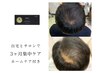 【強髪】ヒト幹細胞培養液濃度100%強髪3ヶ月6回コース(ホームケアつき)