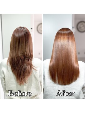 エセット(ECET) ECET式ストレート