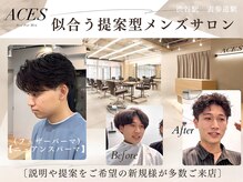 エース(ACES)
