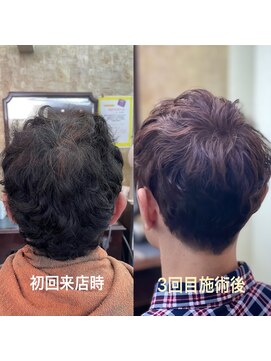 アンヌ メンズくせ毛カット