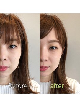 パース ビス 松戸西口店(PARS bis) Lift Up Collection