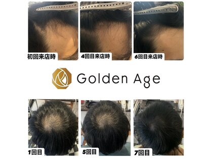 ゴールデンエイジ(Golden Age)の写真