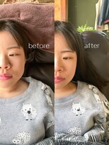 リアン(lln) ヘッドスパ