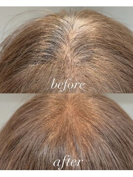 白髪ぼかしビフォーアフター