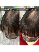 ツムグ 代官山店(TUMUGU)&nbsp;おとな女性髪の悩み【地肌見え】ボリュームアップエクステ1000本