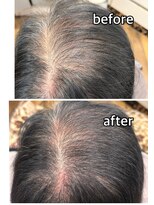 エミ(EMI)&nbsp;育毛促進