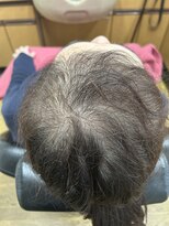 ヤスイ(YASUI)&nbsp;育毛促進３ヶ月