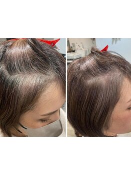 白髪染めを辞めたいけど不安な方に、安心の30分初回カウンセリングで白髪診断をいたします【白髪ぼかし】