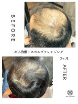 ヘアディボーション(HairDevotion)&nbsp;頭皮毛髪改善プログラム