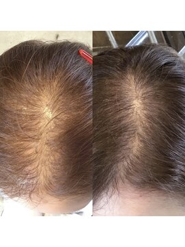 サーカス 銘苅店(circus) 【頭皮集中プレミアム】 本気のボリュームケア｜