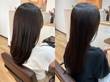 ロノキュア(Lono×cure)