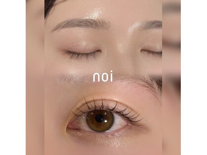 ノイ(noi)の写真