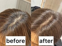 お客様の声３：丁寧なカウンセリングで安心しました◎