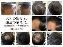 ゴールデンエイジ(Golden Age)の雰囲気（男性特有の髪や頭皮のお悩みはお気軽にご相談ください！）