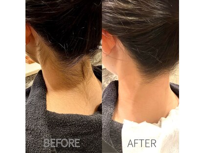 ルナメディカルヘアサロン(LUNA)の写真