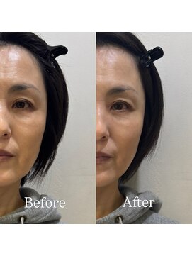 ラビリンス(Labyrinth) ヘッドスパ/髪質改善/トリートメント/強髪/リフトアップ