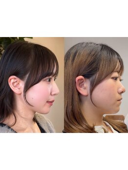 ≪福島市≫レイヤーカット、くびれ巻き…韓国スタイルなら”nea"にお任せください。高い技術で再現性◎