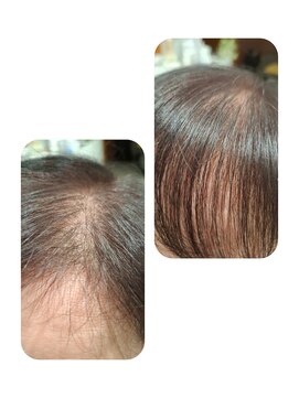 ユーフォルムギンザ(y-Forme Ginza) 話題のトキカタ♪前髪編