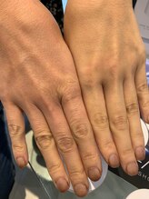 拭き取り美容液エクスフォリエーター（角質柔軟美容液）でみずみずしい誰もが羨むクリアな素肌へ！