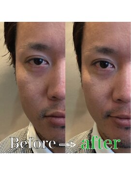 パース ビス 松戸西口店(PARS bis) Lift Up Collection