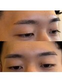 BDBwax脱毛