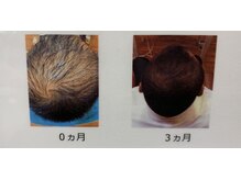 シュリット ヘア(schrit Hair)の雰囲気（最先端のエイジング「再生因子」を使用した施術やホームケアあり）