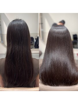 メルス(MeLS) Before→After  08