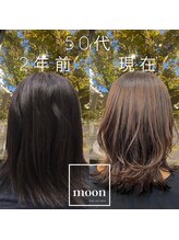 ムーン(moon) 50代髪質改善の変化/年齢によるうねりはスパと栄養補給