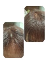 ユーフォルムギンザ(y-Forme Ginza)&nbsp;話題のトキカタ♪前髪編