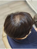 ～幹細胞ケアで分け目ケア～