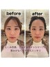 【小磯指名限定クーポン】ハツラツ小顔spa30分+カット+カラー
