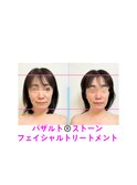 フェイスラインのリフトアップ♪