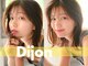 ディジョン(Dijon)の写真