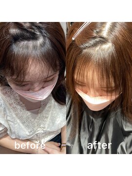 グリン 栄(grin) お顔周り矯正