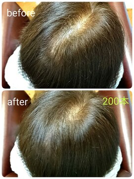 グリーン(green) つむじカバーボリュームアップエクステ200本☆