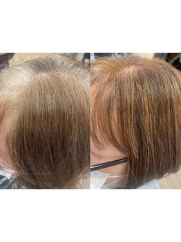 【堺東★女性Staffのみ】白髪を染めない白髪染めが長持ちの秘訣！赤みが目立たない上品な褐色を再現♪