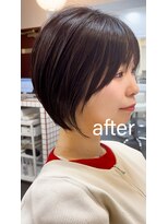 ライラ(LAILA) Before after
