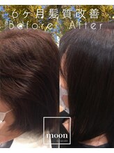 ムーン(moon) 髪質改善6カ月の変化/スパと栄養補給でハリコシUPし艶髪へ