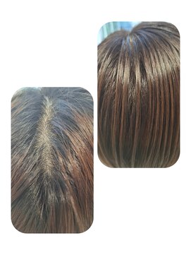 ユーフォルムギンザ(y-Forme Ginza) 話題のトキカタ♪頭頂部編