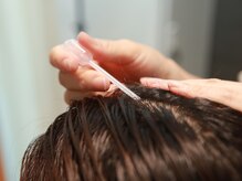 【ヒト幹細胞培養液の塗布】お悩みに合わせた美容液を塗布します。