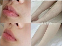 ハヤリ(HAYARI)の雰囲気（その他のメニューも充実♪2階店舗オープン。珍しい総合サロン！）