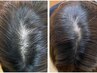 分け目・つむじのボリュームが気になる方へ|ヘアループ体験100本