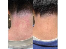 バーバーサンハチ(BARBER 38)の雰囲気（肌、神経系もご相談下さい！【メンズカット/ヘッドスパ/幹細胞】）