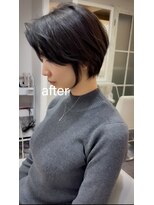 ライラ(LAILA) Before after