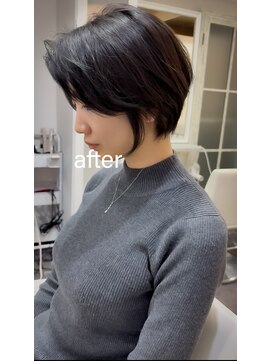 ライラ(LAILA) Before after