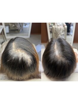 【北谷】に増毛エクステ専門店がオープン！薬剤を使わずに自然なボリューム感◎お気軽にお試しください♪