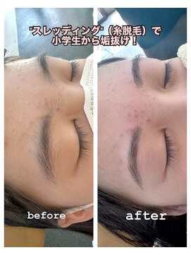 マツ 美容室(Matsu 美容室) 眉毛とお口周りのケアしませんか？