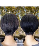 ムーン(moon)&nbsp;頭皮改善＆髪質改善ケア20代の変化